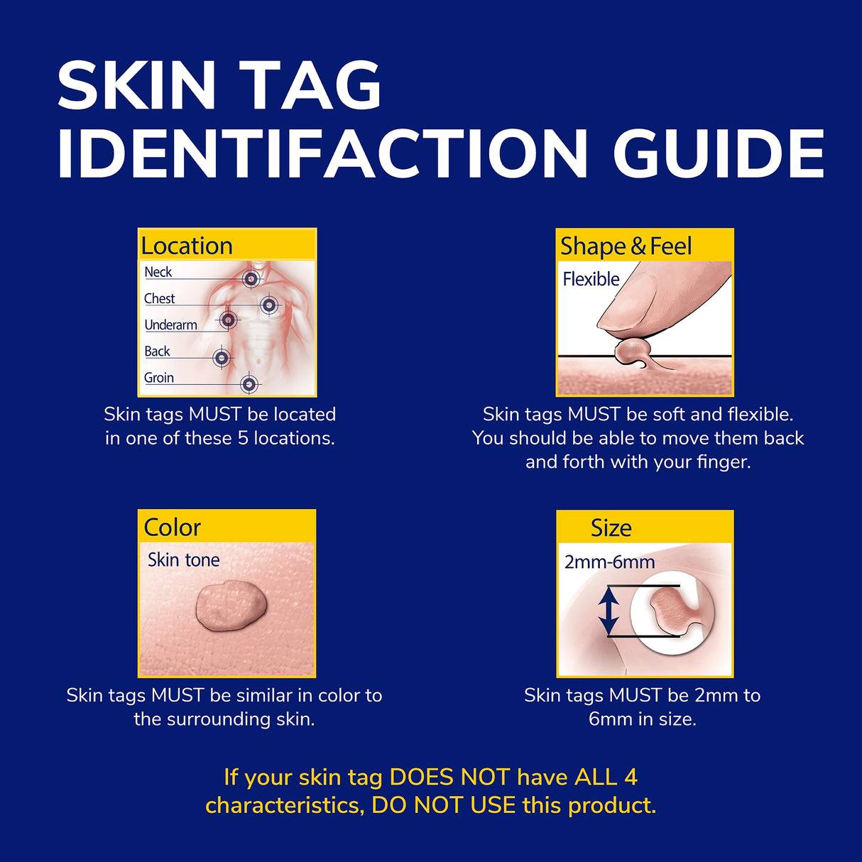 Freeze Away® Skin Tag Remover